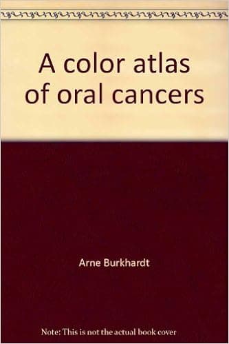 A color atlas of oral cancers (Wolfe color atlas series)