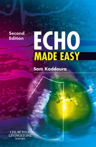 Echo Made Easy E-Book