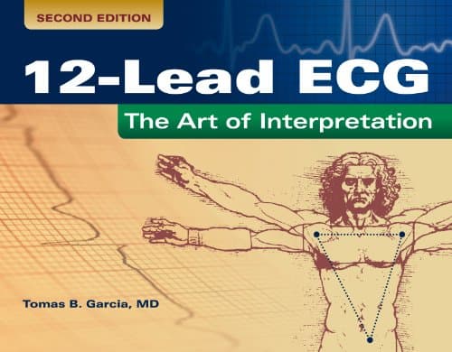 12-Lead ECG: The Art of Interpretation (Garcia, Introduction to 12-Lead ECG)