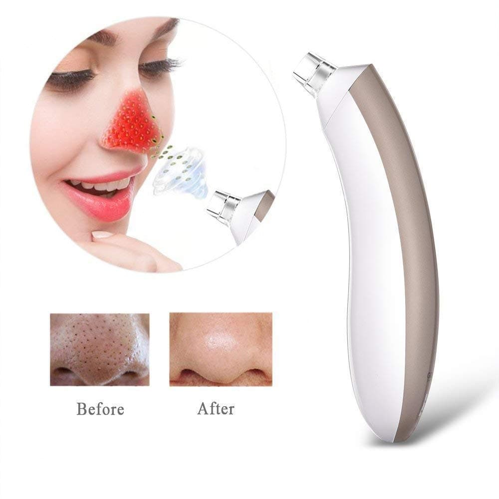 GOODSKY Blackhead Extractor Comedo Suction - Electric Blackhead Removal Vacuum Suction Machine,Comedone Extractor Facial Pore Cleanser, USB Rechargeable (Gold)