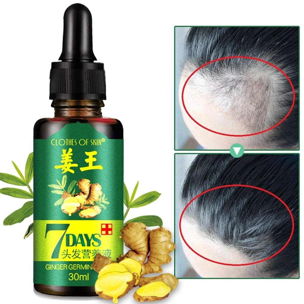 Ginger Germinal Oil,2019 Hair Growth Oil ,Hair Growth Treatment for Women Men With Thinning Hair Loss Serum for Healthier, Thicker, Longer Hair