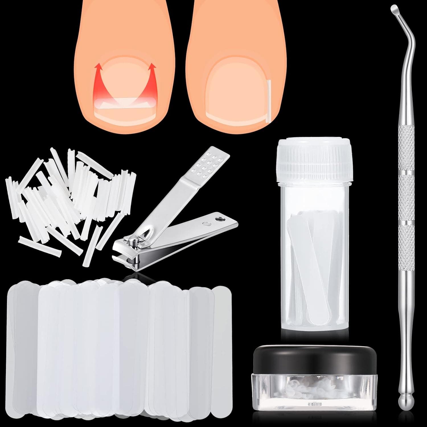 100 Pieces Ingrown Toenail Corrector Strips Ingrown Toenail Correction Pad Corrector Recover Clips with 3 Pieces Ingrown Toenail File Lifter Nail Clipper Toenail Correction Kit for Women Men Feet Care