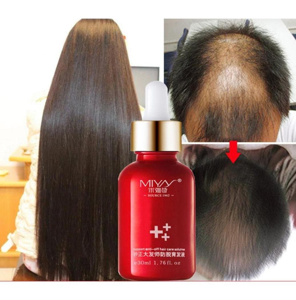 Hair Growth Oils - Fheaven 30ML Hair Growth Essence Advanced Thinning Hair & Hair Loss Supplement