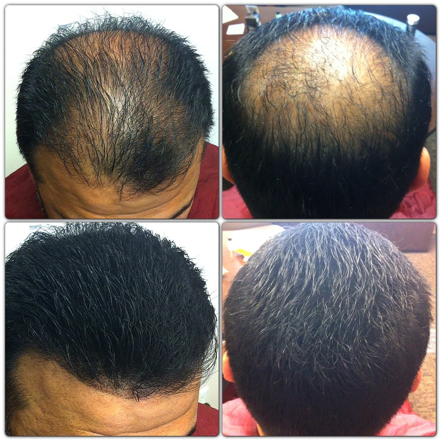 Meantime Thin Hair Enhancement Fibers (Black) NO BOX - Never opened