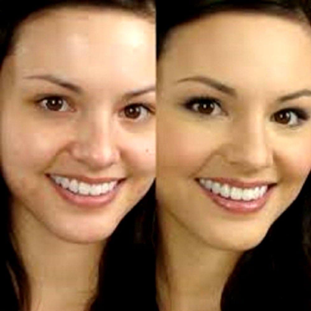 Retinol Cream 0.05G, 3.5 oz./100g, Acne, & Anti Aging Wrinkle Cream
